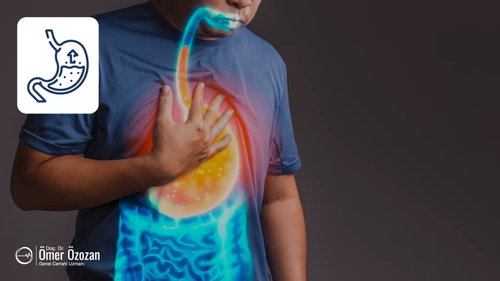 Gastroözofageal Reflü Hastalığı (GERD) ve Tedavisi