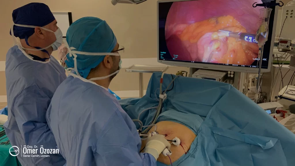 Laparoskopik Cerrahi