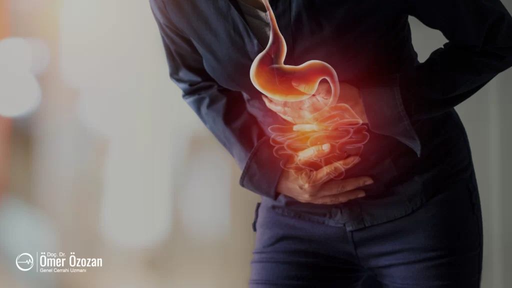Reflü Hastalığı ve Tedavisi