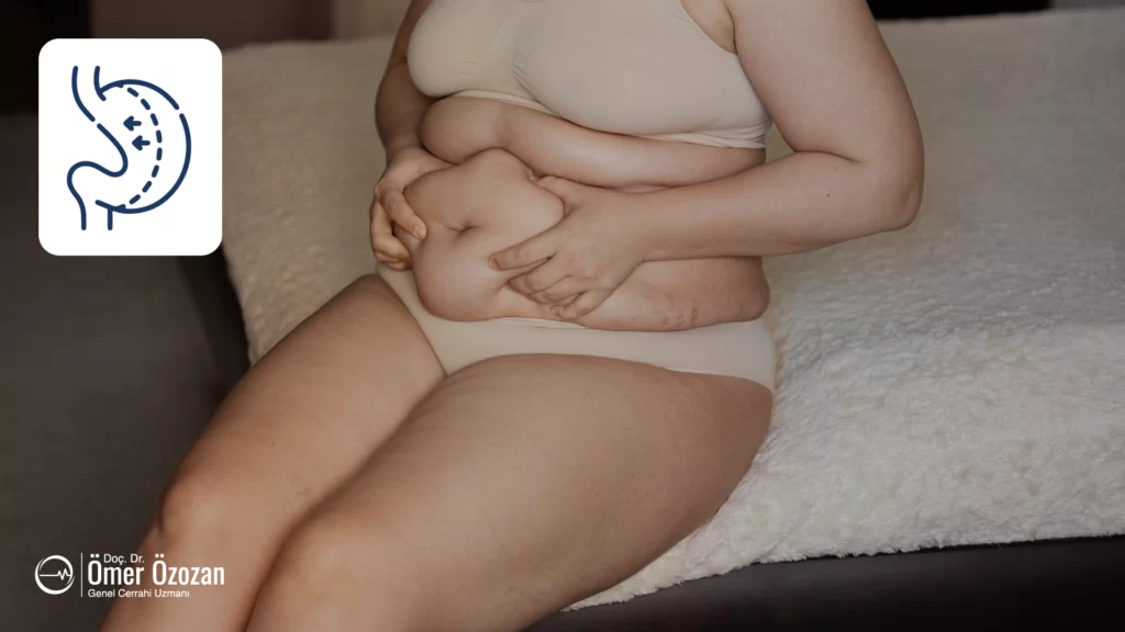 Tüp Mide Ameliyatı