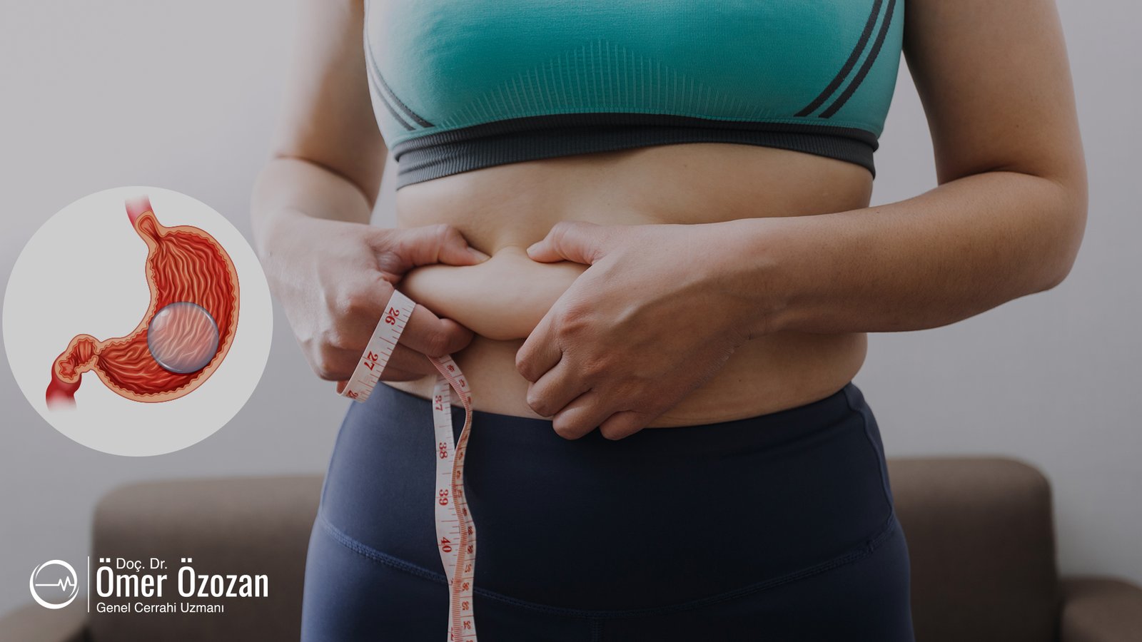  Yutulabilir Mide Balonu: Yerleştirilmesi ve Çıkarılması